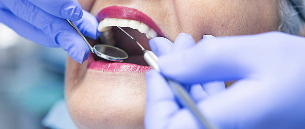Best Chipped Tooth Repair Near Me  in Santa Rosa, CA